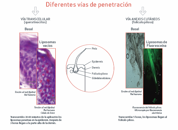 vía penetración